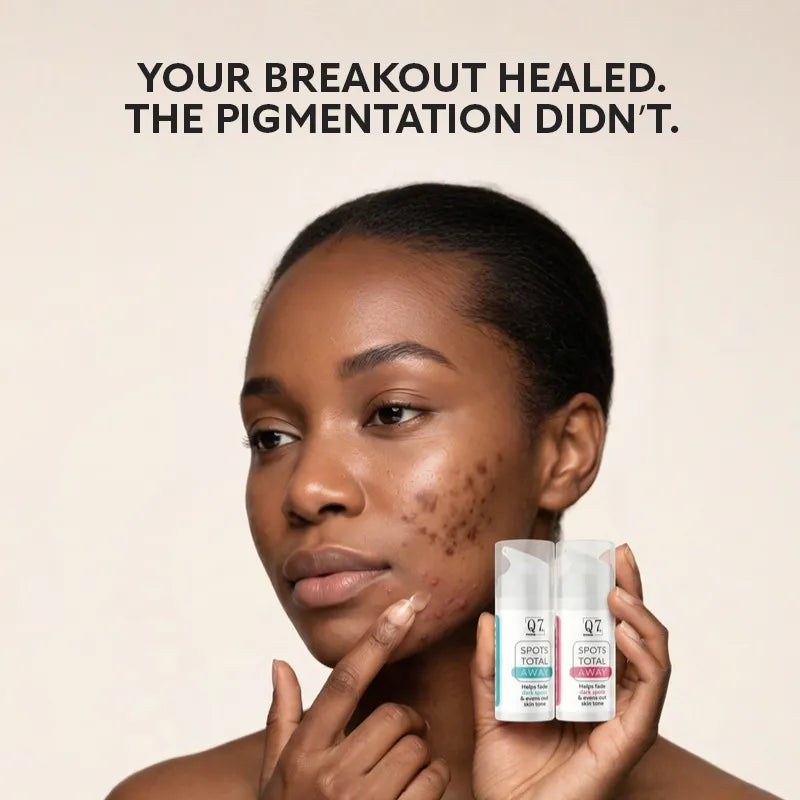 Why Your Acne Always Leaves Dark Marks (Even When It Heals)