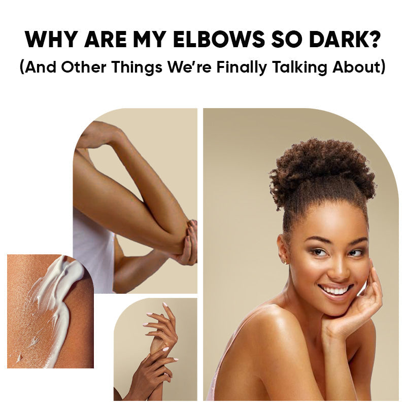 Why Are My Elbows So Dark? (And Other Things We’re Finally Talking About)